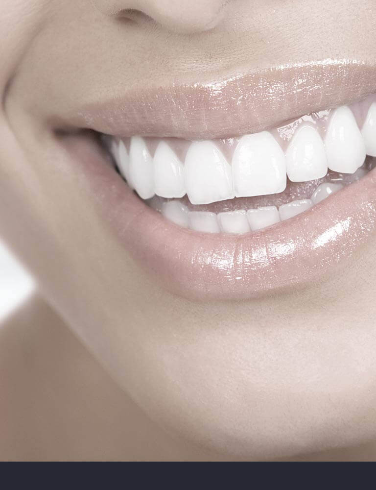 Full Ceramic Aesthetic Dentistry Full Ceramic Aesthetic Dentistry