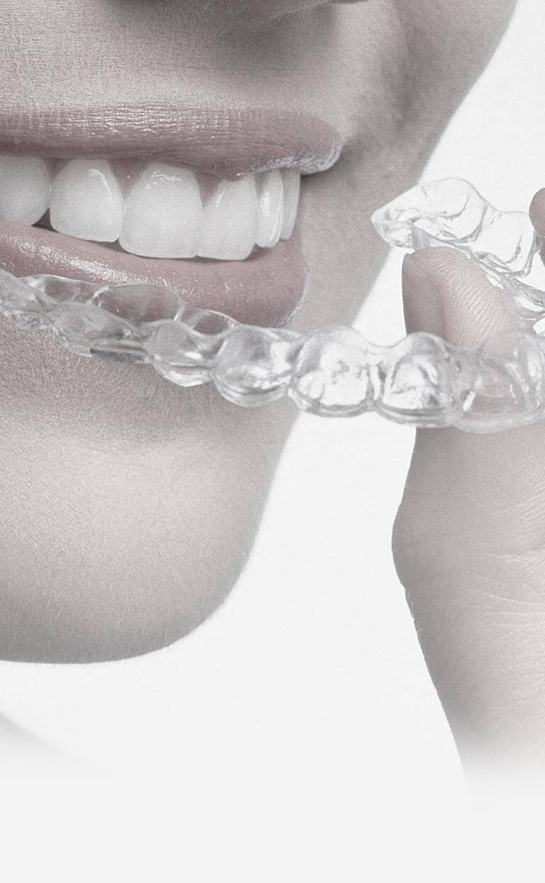 Invisalign® or Clear Braces - Smiles by German Design