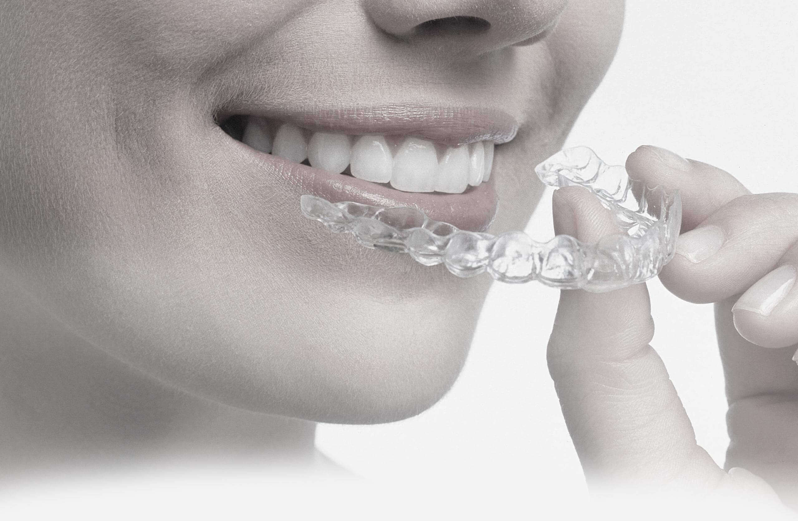 Modern state of the art orthodontic treatment in Berlin